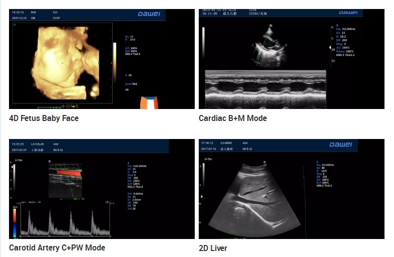 GH-T6 4D Color Doppler Ultrasound System Machine OB GYN