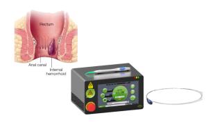 China 15 Watts Laser Treatment Machine Painless Hemorrhoid Removal 1470 NM Diode Laser wholesale
