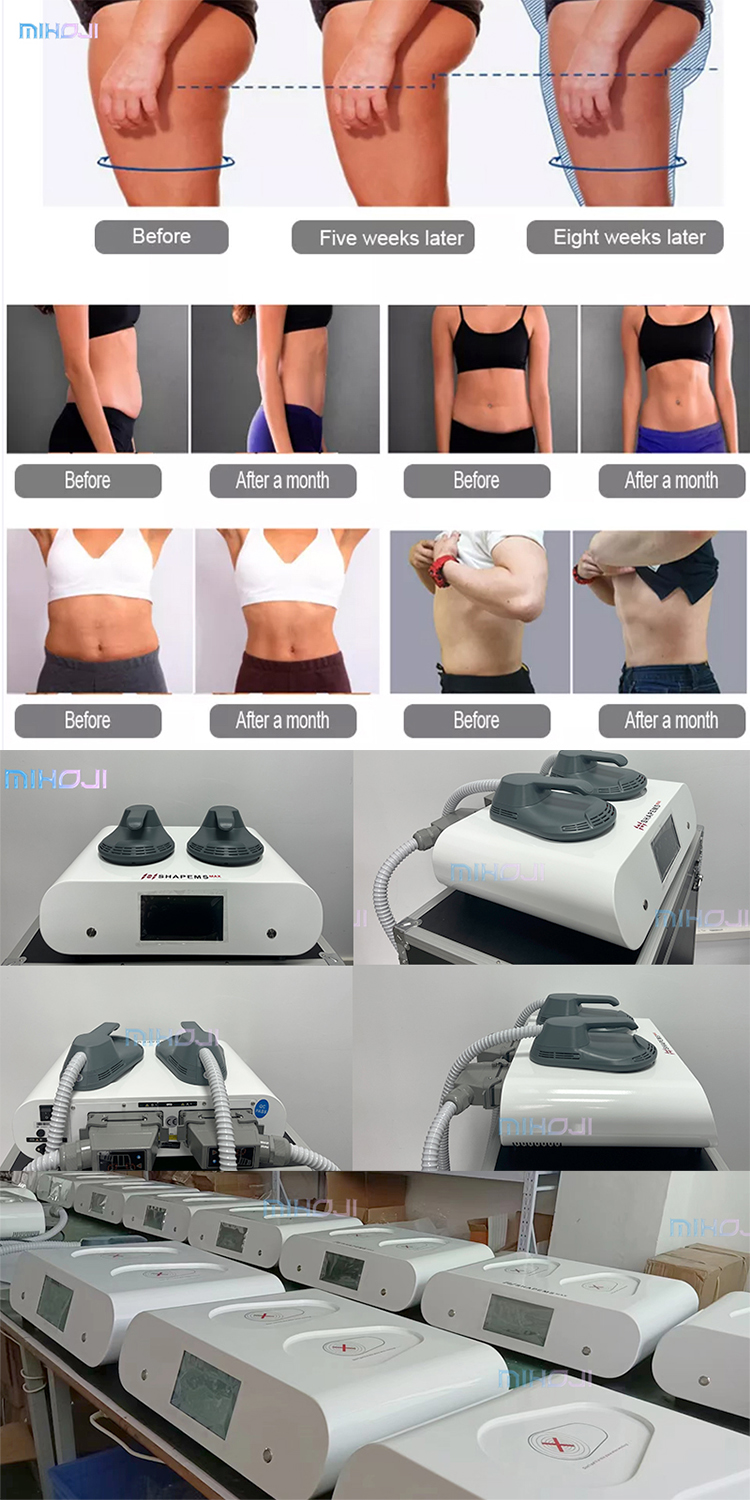 EMSlim 2 Handles EMS Body Slimming Machine 150Hz For Enhanced Muscle