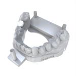 Pressed Ceramic Crowns Permament Dental Resin for All Sizes of Dental Businesses