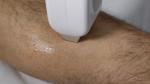 Alexandrite Diode Laser Hair Removal Machine