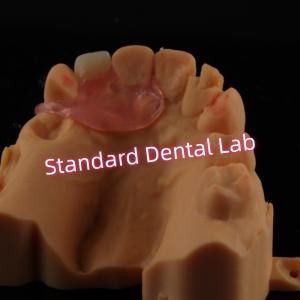China Upper Valplast Unilateral Dentures Removable Flexible One Tooth Partial Teeth wholesale