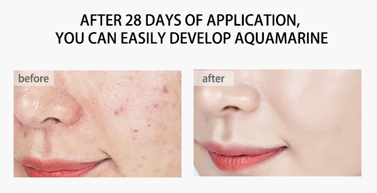 60g Herbal Mint Cool Moisturizer Facial Cream Remove Scars Anti Acne