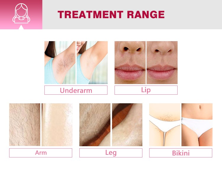 ce approved diode laser newest 808nm diode laser removal machine diode laser 755 808 1064nm 1600w salon beauty equipment price