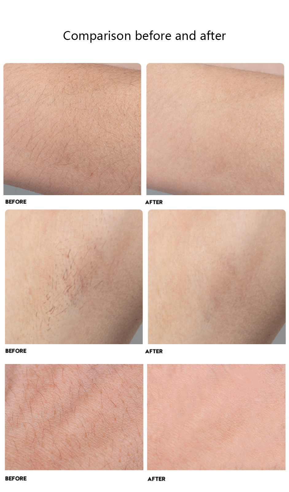 Home Use Hair Removal Beauty Machine 300W Diode Machine 808 Laser