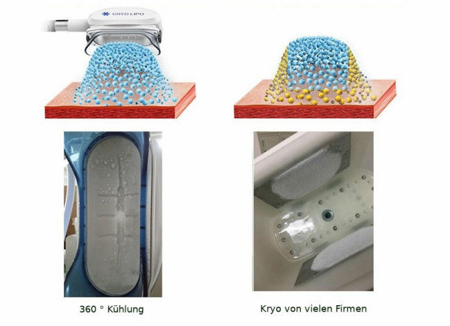 500W Portable 360 Cryolipolysis Cryo Fat reduction Machine