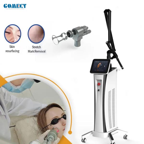 Fractional Laser Skin Treatment Scar Stretch Marks Removal Co2 Fractional Laser