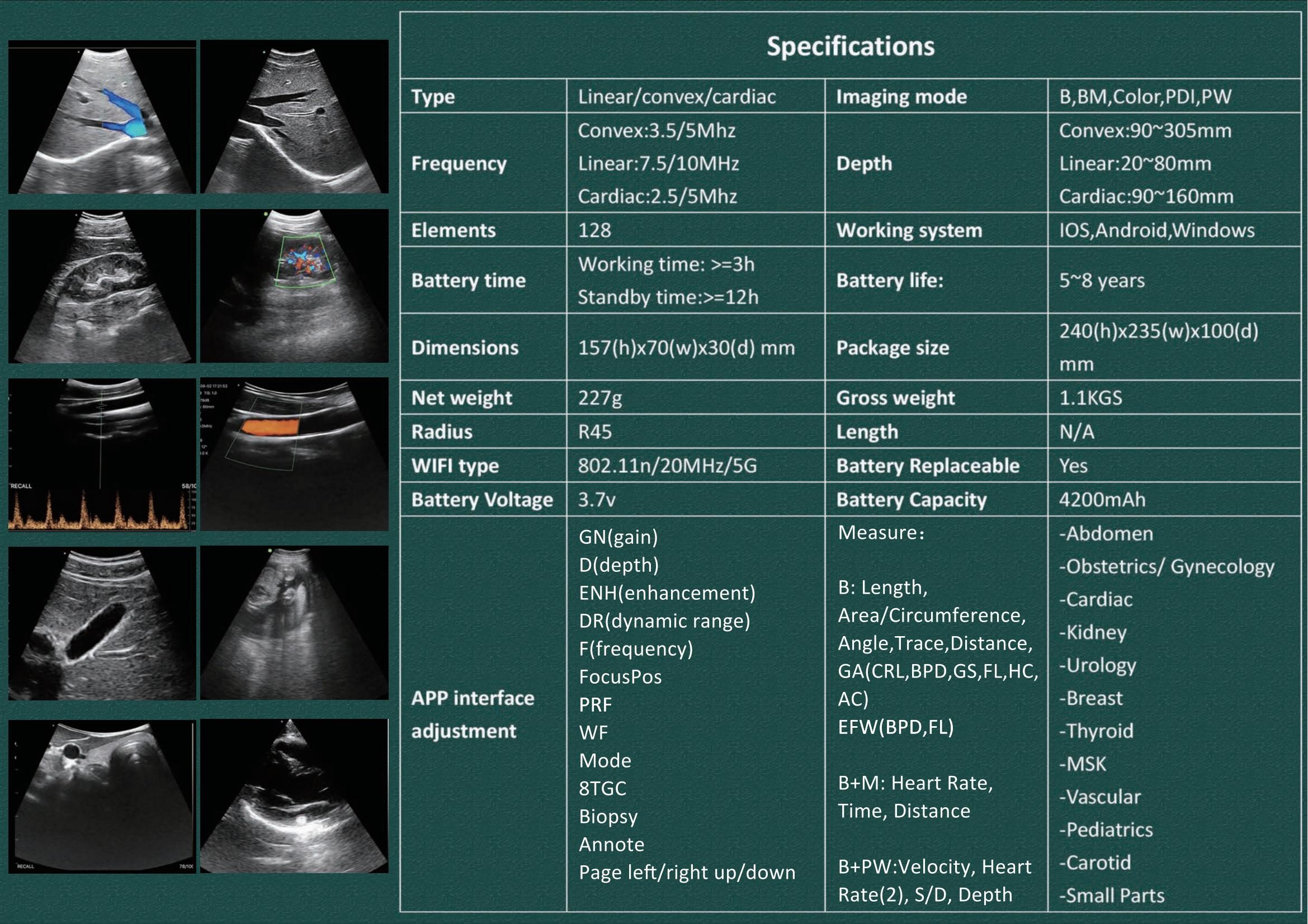 DICOM Medical Hospital Equipments 128 Element Portable Wifi Wireless Ultrasound Scanner