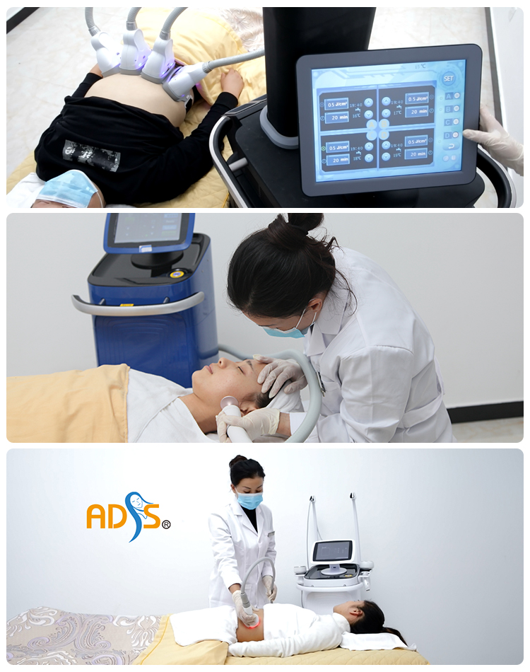Vacuum Roller Massage Machine , Infrared RF Vacuum Roller Slimming Machine