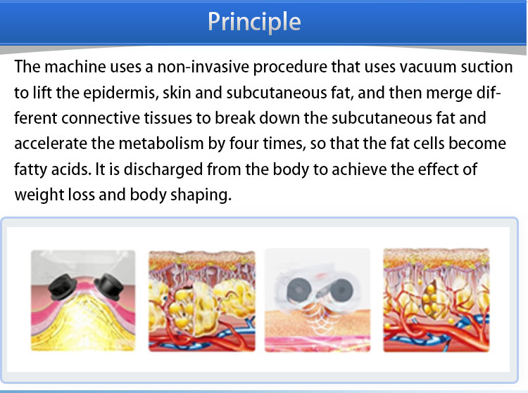 Skin Tightening Vacuum Roller Slimming Machine , RF Laser Body Contouring Machine
