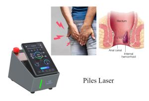 China Two Wavelength Diode Laser Machine 980nm 1470nm Hemorrhoid Treatment wholesale