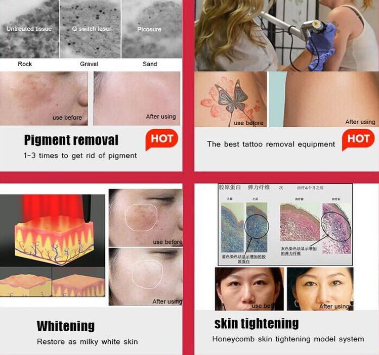 220V Picosecond Laser Tattoo Removal Machine For Cleaning Skin Rejuvenation
