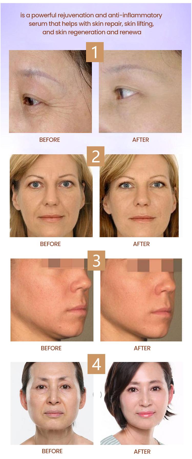 Cytocare 502 516 715 640 5ml X 10vail 5vail Serum Cytocare