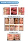 GOMECY 2024 Facial Skin Care Co2 Fractional Laser Stretch Mark Fractional Co2