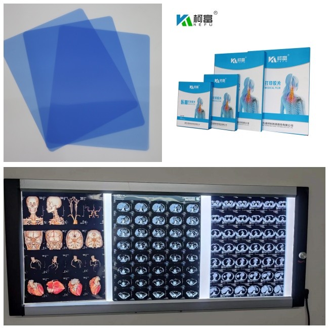 Compatibility Canon / Epson Inkjet Printers Inkjet X Ray Film 210 Microns Blue Film Thickness