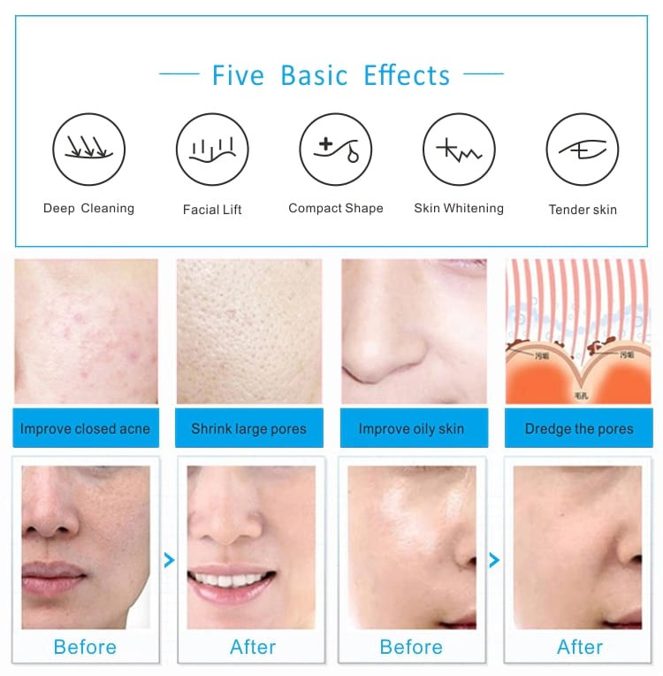 6 In 1 Photon Light Therapy Machine PDT Hydrafacial Care Beauty Device