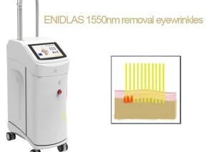 China CE Stretch Marks Removal Machine Laser Erbium Glass 1550 NM wholesale