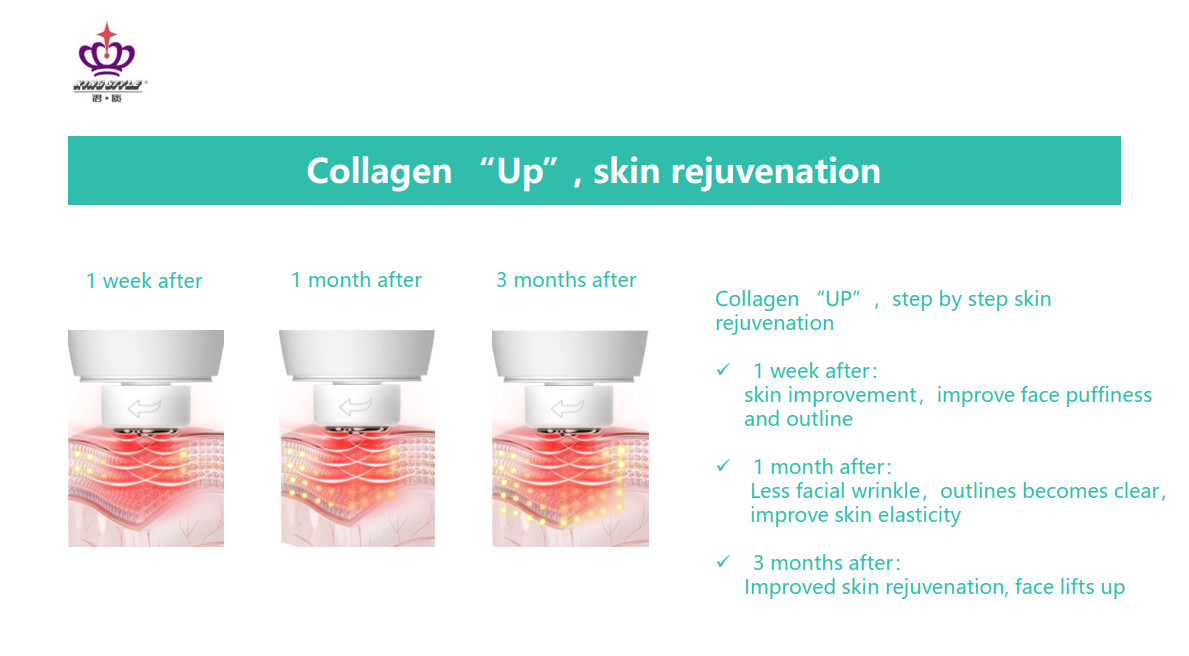 Ultrasonic Slimming Skin Tightening RF Beauty Instrument