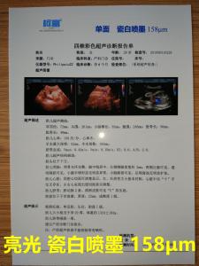 China 125 Microns White Base Opaque Inkjet Medical Film Three Dimensional CT Scan Film wholesale
