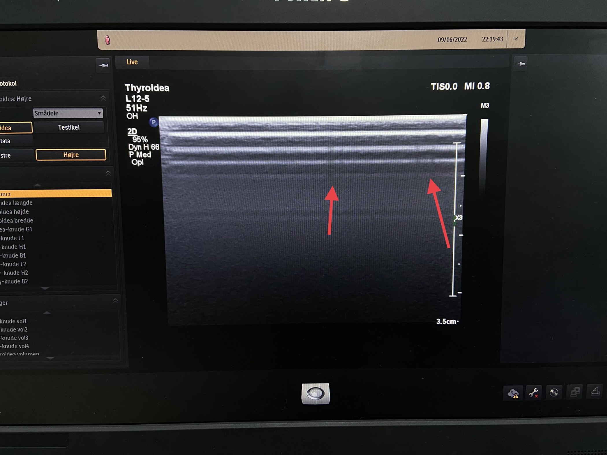 L12-5 Ultrasound Probe Repair For Array Replacement