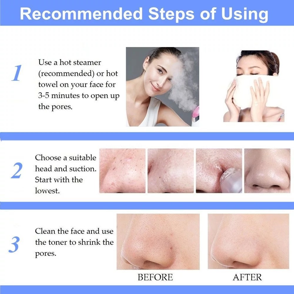 Acne Removal 3.7V DC Pore Suction Vacuum Blackhead Remover