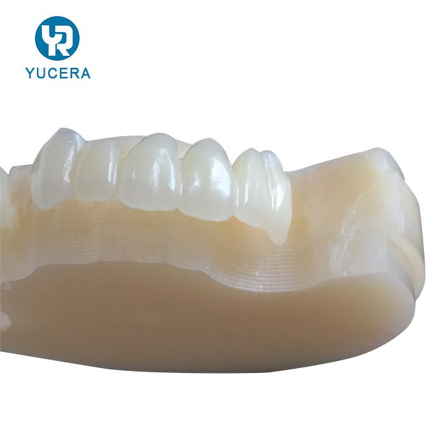 10mm - 25mm Dental PMMA Blocks Denture Restoration Multilayer PMMA Disc