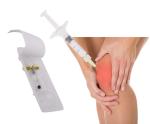 Knee Osteoarthritis Mesotherapy Treatment Non Cross Linked Hyaluronic Acid