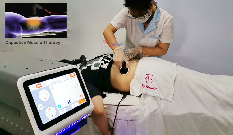Indiba Face Lifting Radio Frequency Tecar Therapy Physiotherapy Diatermia Machine