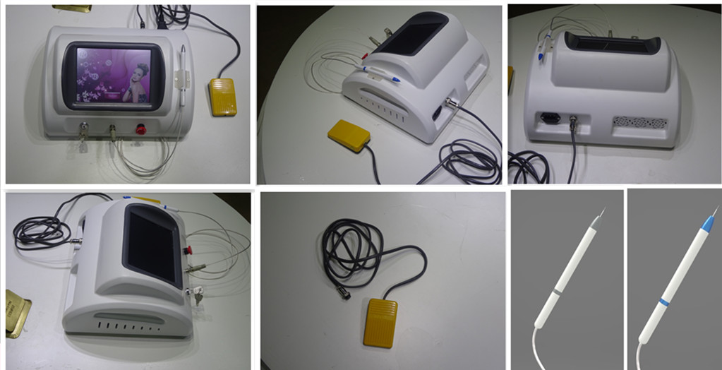 2015 newest high frequency 30mhz spider vein removal machine