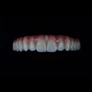 China Full Coutour Arch Zirconia Fixed Dentures Crown Biocompatible Material wholesale