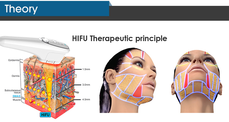 Newest Perfect Laser Skin Tightening Wrinkle Remover Skin Hifu Body Slimming Machine