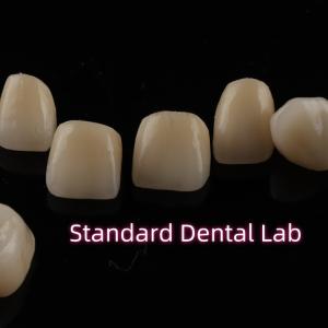 China Dental Strong Layered Zirconia Crowns Full Upper Arch Restoration wholesale
