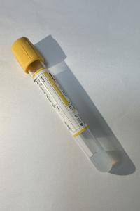 China Infectious Disease Screening Smart Separation Technology Rapid Clotting Acceleration wholesale