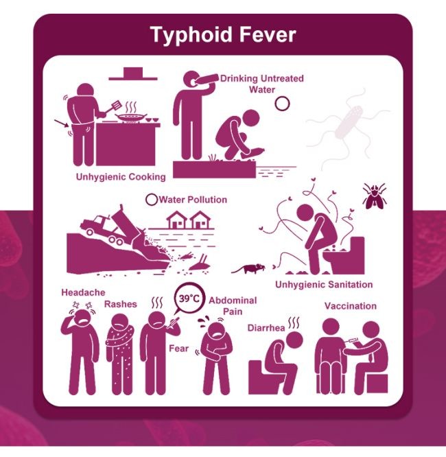 Typhoid IgM / IgG Rapid Antibody Test Cassette One Step 40 Tests/Kit