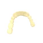 Luxurious Aesthetics Temporary Crown Resin Superior Strength