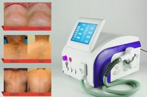 China 12*20mm 808nm 755nm 1064nm Laser Hair Removal Equipment wholesale