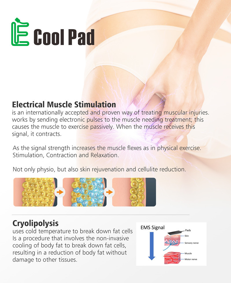 Cryolipolysis Body Slimming Device With 4 PCS Pad Handles No Bruising