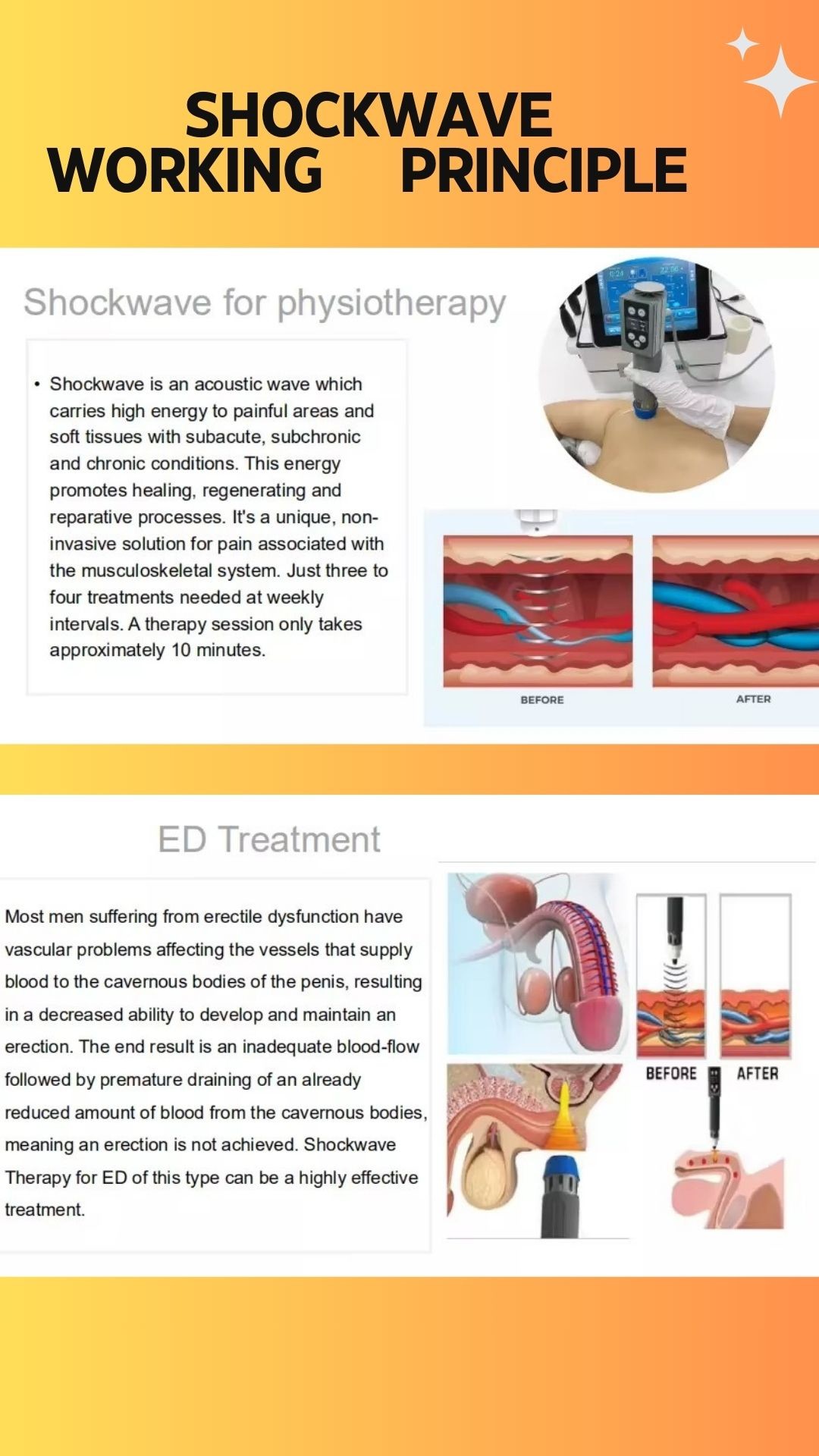 Energy 5-200 MJ 3in1 Smart Tecar Wave Machine for Shockwave Therapy and RET CET Treatment