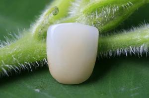 China Great Fitness Full Ceramic Biocompatible EMAX Dental Crown wholesale