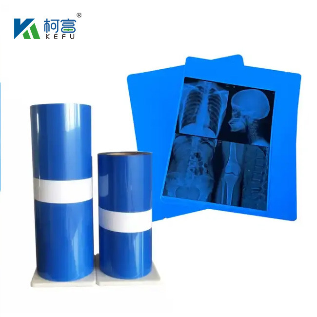 CT Scanner Dry X-ray A3 / A4 Medical Ink Jet Blue Film X-ray PET Film