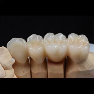 China Biocompatible Zirconia Ceramic Dental Crown Tooth Restorations Custom wholesale