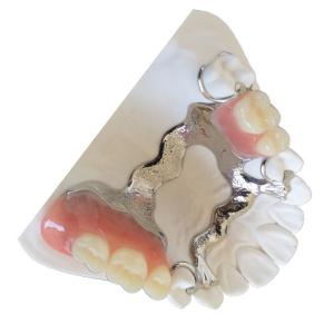 China Customized PFM Tooth Crown 3D Printing PFM Dental Bridge wholesale