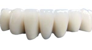 China Beautiful Porcelain Dental Crown Not Easy To Wear Acid And Alkali Resistance wholesale