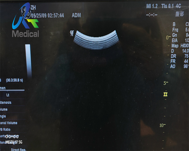 GE 4C Convex Array Ultrasound Transducer Ultrasonic Cleaning Probe For Diagnosis Device