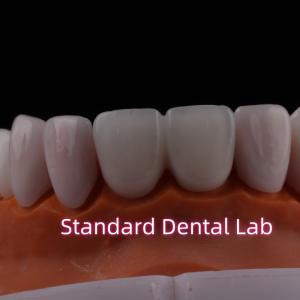 China Tranlucent Emax Zirconia Laminate Veneers Porcelain Dental Veneers Chemically Verystable wholesale