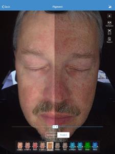 China Facial 3d Skin Analyzer Scanner Visia 32gb Storage For Doctor Skin Clinic wholesale