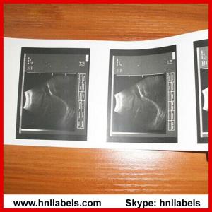 China Ultrasonic Paper Compatible UPP-110s Medical Printing Media(Upp-110s Paper) wholesale