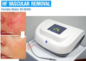 China Painless 30MHz High Frequency Skin Care Machine For Spider Vein Treatment wholesale