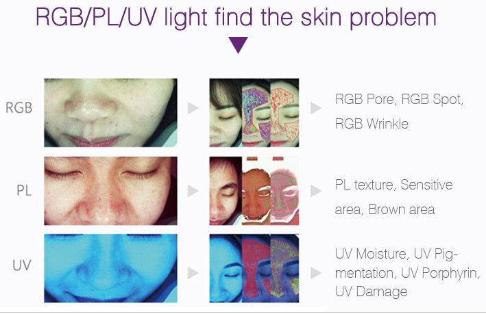 UV Light 3d Smart Skin Hydration Analyzer PDF Print For Beauty Salon