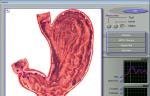 3d Mra / 3d Nls Quantum Resonance Health Analyzer Machine